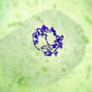 초파리 침샘염색체 슬라이드